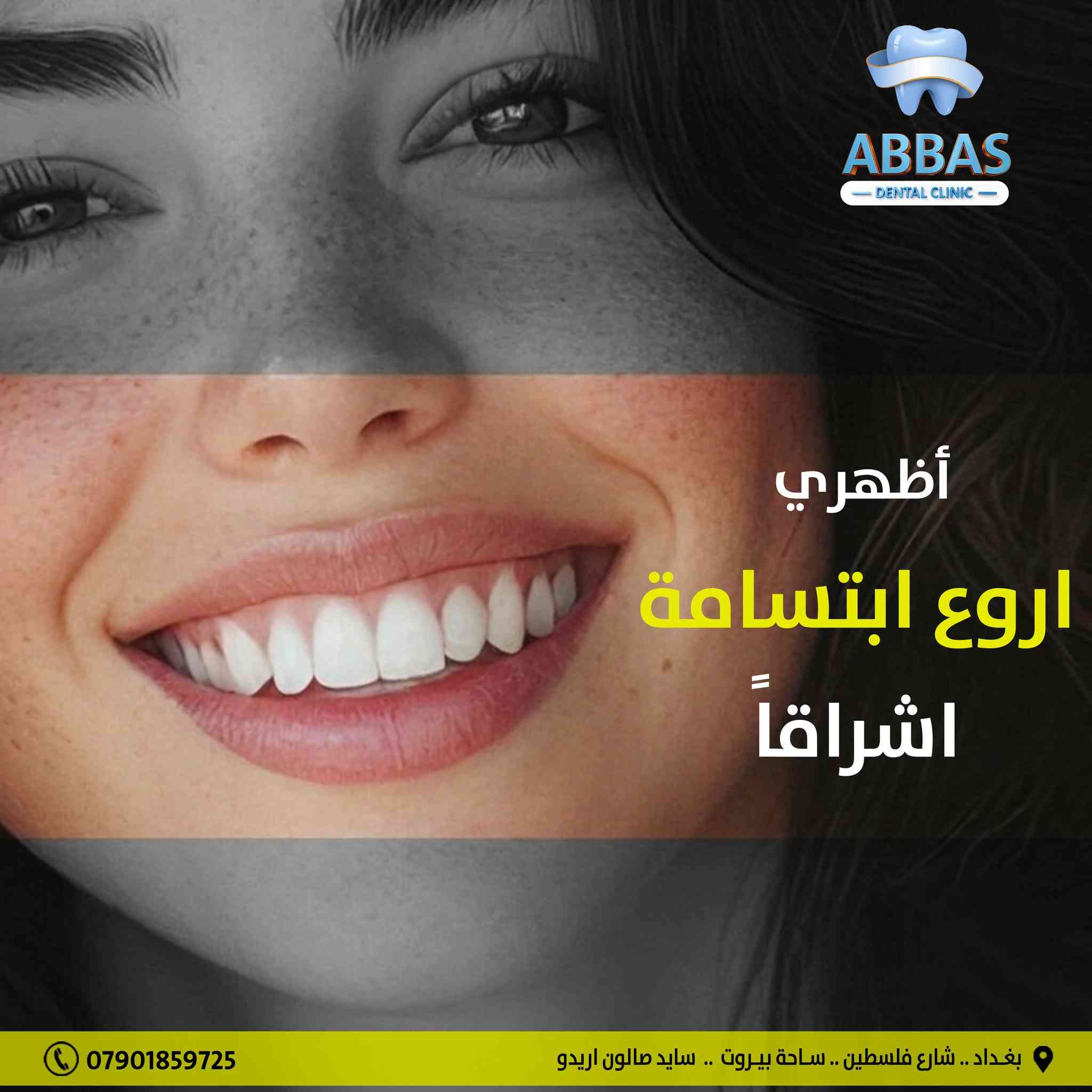 خلّي ابتسامتك تحچي عنك 😁
.     .     .     .     .     .     .     .      .      .      .      .      .     .     .
📍 بـغـــداد .. شــارع فـلسـطـيــن .. ســاحـة بـيــروت .. بـســايد صــالـون اريــدو
📲 للحجز والاستفسار يمكنكم الاتصال بالارقام التاليه : ***********.
#اسنان #تقويم_اسنان #طبيب_اسنان #زراعة_الاسنان
