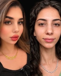عروض مجمع فلة الطبي الفلر الكوري المصرح من وزارة الصحة السيسي 75 الف  ...