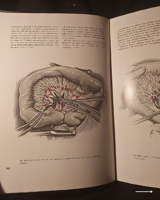 "أطلس جراحي طبي نادر وفخم من روائع الطب السوفيتي الأكاديمي! "
🚩
🫁
🩺
💚
📘
(Atlas of Thoracic Surgery - Volume Two)
المحرر: الأكاديمي بوريس ف. بيتروفسكي (Academician Boris V. Petrovsky).
⚜️
📚
🚩
☭
✨
عن هذه النسخة التراثية:
سنة الطبع: 1979م (طبعة أصلية قديمة ونادرة صادرة عن دور النشر العلمية السوفيتية المترجمة للإنجليزية).
الحالة: ممتازة
✅
⚜️
الموضوع:
أطلس جراحي موسوعي وفخم يتناول جراحة الصدر والأوعية الدموية الكبرى والقلب والرئتين بالتفصيل التشريحي والعملياتي الدقيق، يضم مساهمات كبار علماء الجراحة في الاتحاد السوفيتي السابق، يهم جداً أطباء جراحة الصدر والقلب، طلاب كليات الطب والصيدلة، وهواة اقتناء المراجع الطبية التراثية الأجنبية النادرة.
🔹
السعر: 35 د. ع.
📜
للحجز
🔻
:
البوت:
@PH_900bot
أو واتساب: ***********
