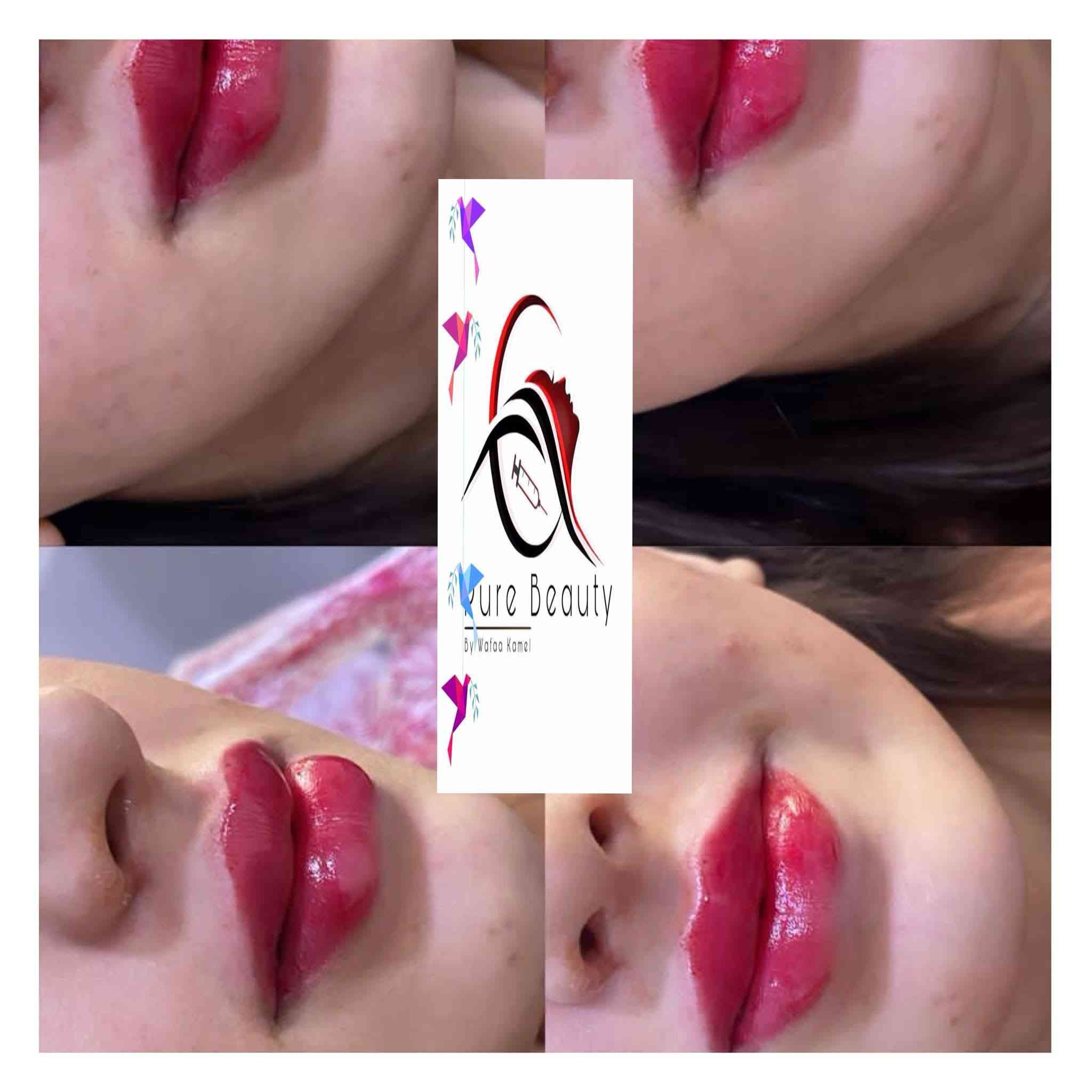 هلاو يا بنات 🥰💖 العيد قرب وحان الوقت لتبرزي جمالج الطبيعي بأحلى شكل! ✨
مع Pure Beauty للتجميل الجراحي، كل عملية تجميل عندنا بتكون احترافية وفخمة، والتفاصيل الصغيرة تصنع فرق كبير 😍💎
والأفضل؟ عروضنا الخاصة رح تخلي التجربة أكثر مغرية وكل بنت رح تحس بالتميز 🔥💫
📍 المكان: داخل مجمع بسمايه السكني
📲 للحجز: واتساب ***********
دللي نفسك وخلي جمالك يتألق بأمان واحترافية 😘✨
https://www.facebook.com/share/1C9cHiuph9/?mibextid=wwXIfr
