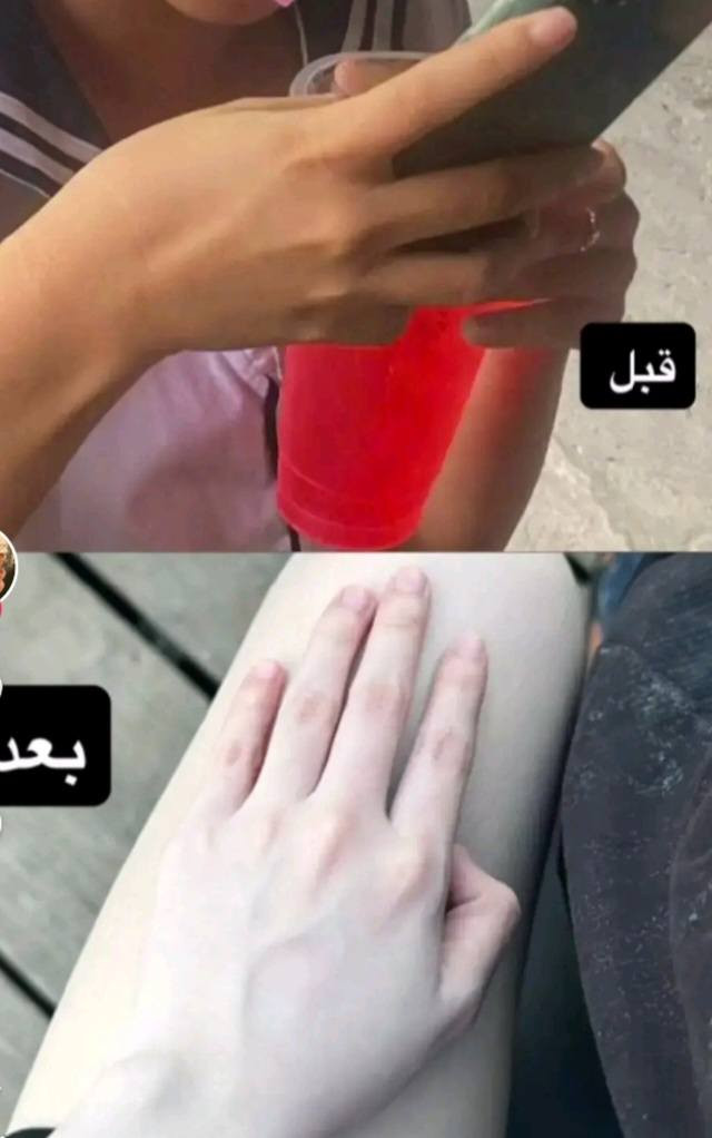 بكج مبيض للبشره والجسم سعر ٣٠ الف


**إذا كنت صاحب هذا الإعلان وتريد حذفه لأي سبب، رجاءا أرسل رسالة إلى الدعم الفني**