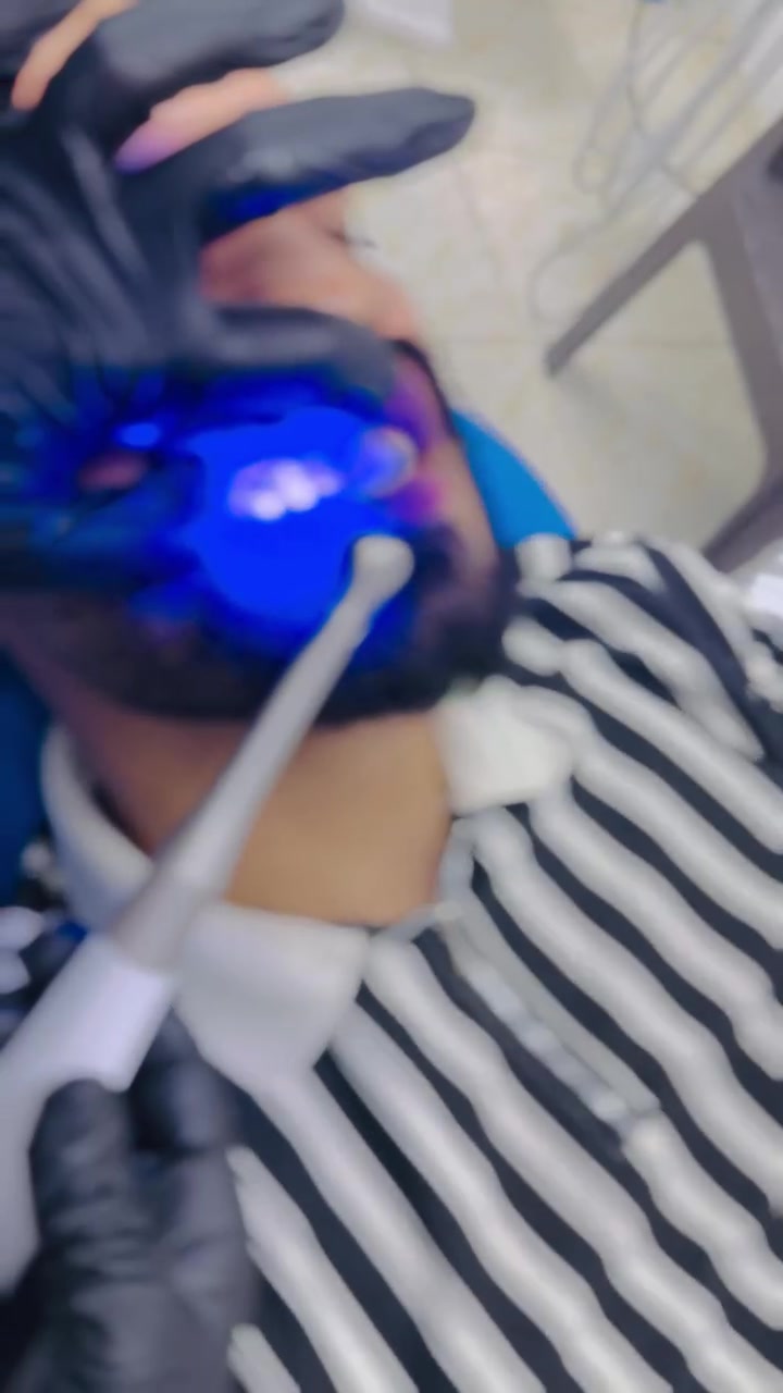 “جربت تنظيف وتبييض الأسنان بعيادة الجمال… والفرق واضح من أول جلسة! 🦷✨
شغل مرتب، تعامل راقي، وابتسامة تفتح النفس. أنصحكم بيها.”

📍 قرب جزيرة بغداد السياحية – شارع المركز
📞 ***********
📞 ***********
