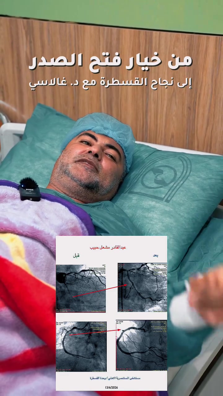 ♦️ نفتح شرايينك بدون فتح صدرك ♦️
✍️ احجز موعد معاينة مع البروفيسور الإيطالي الفريدو كالاسي prof. Dr. Alfredo Galassi 

✅ يختص البروفيسور الإيطالي بفتح الشرايين التاجية للقلب، ويستخدم تقنيات القسطرة المتطورة لفتح شرايين القلب التاجية، والأجهزة الحديثة (IVL، Rota، IVUS)

سيتواجد في مستشفى المستنصرية / بغداد الوزيرية/ قرب الفيزا التركية 🏬في تاريخ 09-07-2026.

ويشغل البروفيسور الإيطالي حاليا منصب مدير مركز القلب التابع لجامعة باليرمو الإيطالية.

عمل سابقا في عدة مراكز عالمية منها :
🔸رئيس الجمعية الأوربية لانسدادات الشرايين التاجية المزمنة (CTO).

🔸بروفيسور في مركز القلب التابع لجامعة زيورخ السويسرية University of Zurich, Switzerland.

🔸بروفيسور في مستشفى رويال برومبتون / لندن Royal Brompton and Harefield Hospital Trust, London, England.

🔸مركز القلب والأوعية الدموية بيرن/ سويسرا Swiss Cardiovascular Center, Bern, Switzerland.

🏣  يرجى الحجز المسبق من الان عن طريق زيارة المستشفى ودفع أجور المعاينة والبالغة 100 الف دينار تشمل فحص الايكو وتخطيط القلب وتسجيل بيانات المريض او عن طريق ارسال حوالة مالية على تطبيق الزين كاش.

☎️ لمزيد من الاستفسارات الطبية يرجى التواصل عبر الواتساب ***********.

⚠️ تحدد كلف القسطرة العلاجية بعد إجراء المعاينة والاطلاع على قرص القسطرة التشخيصية.
 
🌀 يرجى مشاركة المنشور ليصل إلى جميع من يحتاجه.
