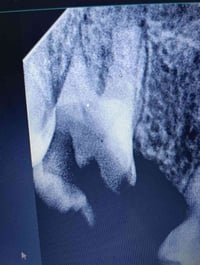 نقدم لكم الخدمة المجانية لقلع الأسنان والجذور المتبقية  كما موضح في ال...