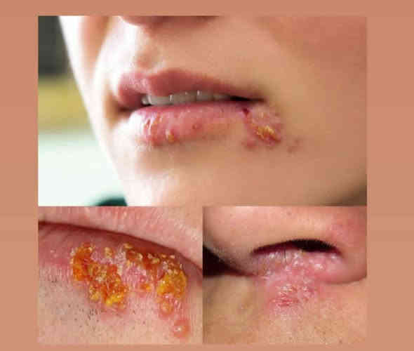 السلام عليكم ، اذا احد عنده هيج حالات بالفم ف يتواصل وياي ، واي شي يشوفه مو طبيعي داخل الفم يدزلي صورته حتى نحدد موعد للعلاج
***********
