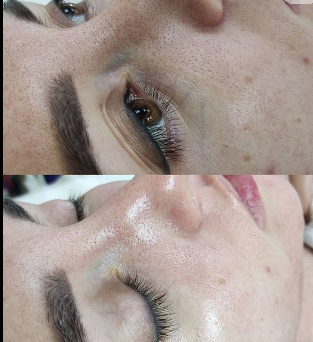 🚨🔥 تنبيه لبنات كربلاء… أقوى عروض العيد وصلت في صالون فدك! 🔥🚨
إذا تريدين إطلالة تخطف الأنظار بالعيد وبأسعار ما تتكرر، لا تفوتين عروضنا الخاصة لفترة محدودة… احجزي قبل الزحمة 💄✨
🌸 العناية بالبشرة
• حف وتنضيف البشرة + جلسة ملكية 10,000
• جلسة تقشير كاربوني 8000
• جلسات الديرمابن لعلاج الوجه 20
(للكلف – الإضاءة والنضارة – آثار حب الشباب والندب)
💇‍♀️ الشعر
• قص وسشوار 5,000
• الميش بجميع ألوانه
الشعر القصير 20
الشعر المتوسط25
الشعر الطويل 35
• صبغ توحيد الشعر
قصير 15
متوسط 20
طويل 25
• سحب لون بارد
قصير 15
متوسط 20
طويل 25
• تغذية وتسريح بضمان المدة
شغل يدوم أكثر من سنتين وآمن للأطفال والحوامل
الشعر القصير 35
الشعر المتوسط 40
الشعر الطويل 65
👂 خدمات إضافية
• ثقب الأذن 5,000
✨ التاتو والوشم بضمان اللون والحبر
جلسـتين 25
(فايبروز – مايكرو – بلوك – تحشا بأنواعه)
✨ خدمات الحواجب والشفاه
• مسح الحاجب بمادة بلون الجلد بضمان – جلستين 20
• تحديد وتوريد الشفاه بضمان اللون – جلستين 25
🖤 جميع أنواع الوشم
السعر حسب حجم القطعة
📍 الموقع: كربلاء – حي الامام علي
مقابل شركة نوفس فرع كوزمتك أوشاك
مقابل بيت بي درج حديد – الصالون بالطابق الثاني
📞 الحجز والاستفسار:
***********
واتساب – اتصال – ماسنجر
✨ صالون فدك… جمالج بالعيد يبدأ من عدنا ✨
