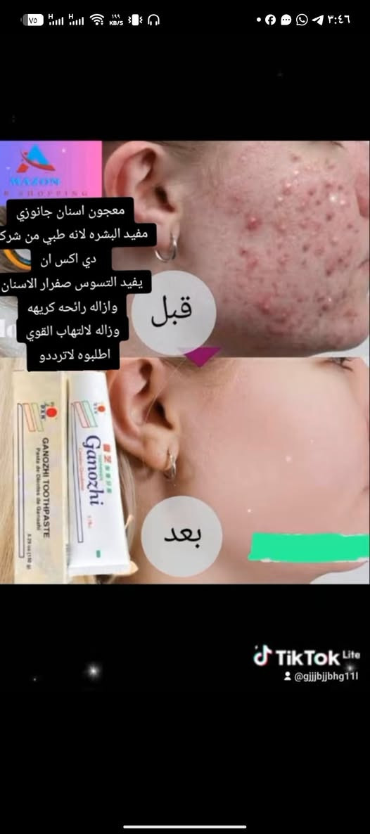 خمسون فائدة 
لمعجون أسنان جانوزي 
من DXN 👍

يطلق عليه اسم المعجون السحري م‌ـــِْن انتاج شركة dxn العالمية اللتي ادخلت فيه خلاصة الفطر الريشي👌

1. لتنظيف الاسنان وعلاج التهابها ,, 
2. القضاء على رائحة الفم الكريهة وتعطير الفم وانعاشه ,,
3. القضاء على النفس الكريهه ورائحة الفم الكريهه ,, 
4. للقضاء على جراثيم الفم الضارة ,, 
5. لعلاج تقرحات واورام اللثة ,,
6. لعلاج السعال استنشاقا ,,
7. لتخفيف اعراض الرشح والانفلونزا استنشاقا ,,
8. يساعد على اندمال الجروح و الخدوش دهنا ,, 
9. يعالج الحروق دهنا ,,
10. يعالج امراض القدم وانتفاخ جذور الاظافر دهنا ,,
11. لعلاج الصداع دهنا ,,
12. للتخلص من رائحة القدم الكريهة وانعاشها دهنا ,, 
13. للتخلص من روائح الابطين وما بين القدمين دهنا ,,
14. لعلاج جروح مريض السكر دهنا ,, 
15. لعلاج الفطريات في رحم النساء كغسول مهبلي ,,
16. لعلاج الفطريات الجلدية دهنا او كغسول جلدي على المناطق المصابة ,, 
17. لتعطير الرحم وانعاشه كغسول مهبلي ,,
18. لشد بشرة الوجه دهنا على مناطق التجاعيد ,,
19. لتغذية البشرة وتطريتها واحمرارها دهنا على الوجه ,, 
20. لانعاش الجسم وتعطيره ومنحه الحيوية والنشاط دهنا مباشرا على الجسم بطبقة خفيفة او يخفف بالماء ويغسل به الجسم ,, 
21. لعلاج البواسير دهنا ,,
22. كذلك ينفع في علاج الناسور وسحب الخراج والجراحة منه ,, 
23. يعمل على تجديد وتقوية و ظيفة المناعة في الجسم ,,
24. يخلص الجسم من السموم ,,
25. يحتوى على بروتينات وفيتامينات بكمية وافرة ويزود الخلايا بالأوكسجين مما يعزز من نشاط الجسم ,,
26. يجعل الاسنان اكثر صحة ولمعانا ,, 
27. لا يحتوي على السكر ولا على مواد ملونة ولا على مواد حافظة ,, 
28. يطلق عليه اسم المعجون السحري أو صيدلية المنزل لكثرة فوائده المتعددة ,, 
29. يوفر تغذية ممتازة للثة وجذور الأسنان والفم ,,
30. يستطيع أيضا تعزيز نشاط الجهاز اللمفاوي ، وبذلك يساعد على استــقرار الأعصاب والأمزجة ,,
31. يستعمل كمرهم خارجي لعلاج وتسكين ألم المفاصل واوجاعها ,, 
32. يزيل البثورالصغيرة في بشرة الوجه والجسم دهنا ,, 
33. يخفض بثور الوجه السوداء الرأس ,, 
34. يستعمل كمطهر ومنظف ومعالج للدمامل والخراجات حيث يمتاز بفعالية قوية لسحب الجراحة ,, والخراجات وتنظيف الجلد منها ,, 
35. يعالج اثار حرارة الشمس وحروقها ,, 
36. يساعد على تجميل القدم ويخلصها من طبقات الجلد الخشنة والمتيبسة دهنا وغسلا ,, 
37. يعمل على انعاش القدم وتقوية تدفق الدم اليها مما يسبب في نشاطها وحيويتها ,, 
38. يعالج الطفح الجلدي ,, 
39. يعالج لسعات الحشرات والبعوض ,, 
40. لعلاج حب الشباب وخراجات حب الشباب و دمامله ,, 
41. لعلاج تشقق القدمين وتفطر الجلد ,,
42. لعلاج الاسهال يؤخذ قليل منه ويخلط مع الماء في كوب ثم يشرب فيوقف الاسهال بإذن الله تبارك وتعالى لأنه مواد طبيعية 100 % ,,
43. يعالج الندب القديمه في الوجه والجلد و يخفيها مع الاستمرار ,,
44. استعمل معجون الجانوزي بعد غسل الرأس يالشامبو وذلك بوضع كمية منه على اليد وفرك اليدين لحين ظهور الرغوة فحدثت في الرأس رغوة كبيرة وكأنها رغوة شامبو وحصل انعاش قوي لفروة الراس ورائحة عطرة ,, 
وكذلك استعمل معجون الجانوزي مع غسول الجسم فحدثت رغوة كبيرة وحصل انعاش وحيوية للجسم بفضل الله تبارك وتعالى ,,
45. يفتح مسامات فروة الرأس ويساعد على تنفس بصيلات الشعر ,,
46. يقضي على البكتيريا والفطريات في فروة الرأس ويساعد على تقليل القشرة بشكل ملحوظ ,, 
47. وبسبب إحتواء معجون الأسنان على كميه كبيرة من الجانوزي ( المشروم الأحمر ) والذي من أهم مميزاته أنه يحتوي على نسبه عاليه من الأوكسجين فإنه يمد بصيله الشعر وخلايا فروة الرأس بقدر وافر من الأوكسجين الذي يساعد بالتالي على إعاده الحيويه في الخليه الميته والضعيفة وزيادة نشاطها وبالتالي تطويل الشعر وهذا الأمر مرغوب فيه لدى النساء خاصه ,,
48. يستعمل لعلاج ألم العضلات وتشنجاتها ,, 
49. يساعد على فتح الاوعية الشعرية الدموية في الوجه مما يكثر من عملية تدفق الدم الى بشرة الوجه فيسبب تغذية بشرة الوجه واحمرارها واشراقها وجعلها اكثر حيوية وجاذبية ونشاطا ,,
50. يساعد على فتح مسامات الجلد وبشرة الوجه مما يسبب كثرة التعرق فيؤدي الى تنظيف بشرة الوجه والجلد ,
    صحة وعافية لا تبخلو ا على انفسكم@


**إذا كنت صاحب هذا الإعلان وتريد حذفه لأي سبب، رجاءا أرسل رسالة إلى الدعم الفني**