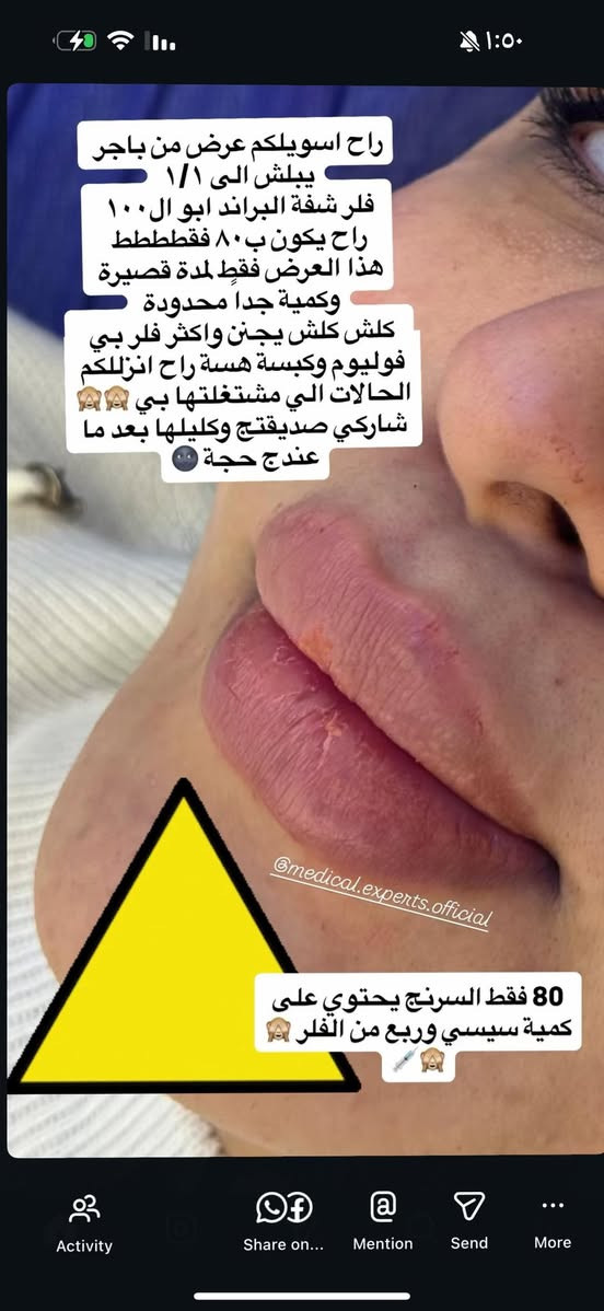 صباحً الخير بنونات 🩷
احلى عروض الكرسمس ويه حنين العزاوي 

ادخلو البوست وشوفو التفاصيل حبيباتي

العنوان /عيادات خبراء الطب التخصصي /الحسينيه المدخل الثالث مقابل كراج الاسدي 

للحجز ***********
