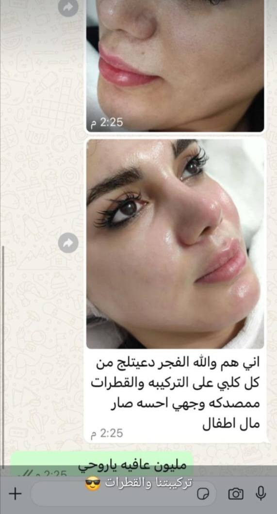 🎉🔥 عرض العيد من د.ليان بيوتي  🔥🎉
بمناسبة العيد حبايبي 💕
كل البكجات ✨ التركيبات ✨ وكل المنتجات
بس بـ 20 ألف وبس 😍
🚚 التوصيل 3 آلاف لكل المحافظات
لا تفوتج الفرصة 💄✨
جددي بشرتج وشعرج قبل العيد وخلي طلتج غير 💖
العرض لفترة محدودة… احجزي هسه قبل لا يخلص 🔥
الجميع


**إذا كنت صاحب هذا الإعلان وتريد حذفه لأي سبب، رجاءا أرسل رسالة إلى الدعم الفني**