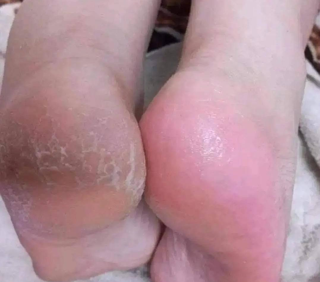 رجعت وياكم بنات بالشغل اسف مجاي انشر ونكطعت بس ظروف


**إذا كنت صاحب هذا الإعلان وتريد حذفه لأي سبب، رجاءا أرسل رسالة إلى الدعم الفني**