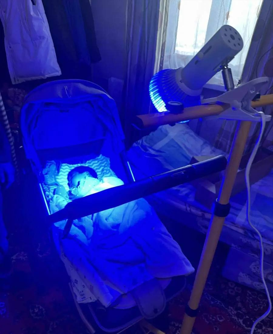 جهاز علاج ابو صفار للأطفال حديثي الولادة
واتساب ***********
