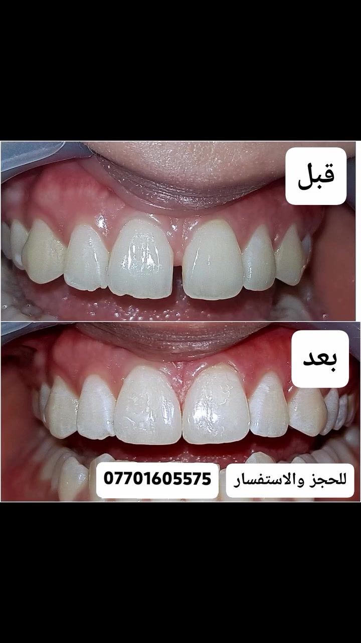 للحجز والاستفسار ***********
