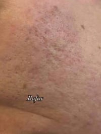 چارەسەری بۆ نوێکردنەوەی پێست و گەڕاندنەوەی جوانی 🌿 ديرمابن به ميزوى فە...