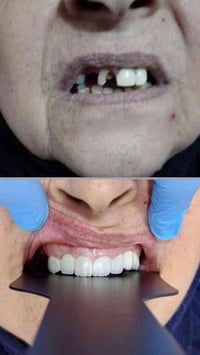 استغلال العروض  مراسله الصفحه واتساب 0776 874 7627