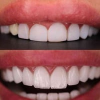 مركز اوتار • تجميل اسنان • الشموخ