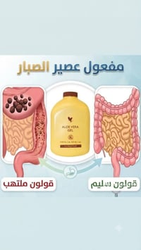 القولون العصبي • جرثومة المعدة • غازات البطن • الاكتئاب والقلق • حموضة...
