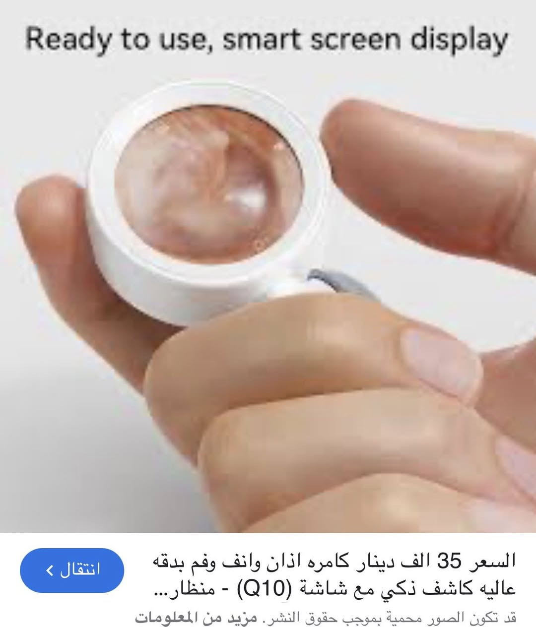 كاميرا اذن وانف سمارت مع شاشه السعر ١٥


**إذا كنت صاحب هذا الإعلان وتريد حذفه لأي سبب، رجاءا أرسل رسالة إلى الدعم الفني**