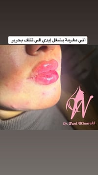 طبيبة أسنان • تجميل لاجراحي • گريضه مقابل نجدة بابل