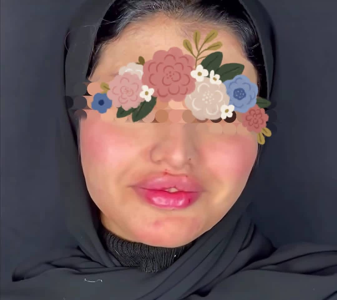 تغير شامل 150عشره سيسي مع ابرة نظاره هديه 💕💕💕💕💕💕


**إذا كنت صاحب هذا الإعلان وتريد حذفه لأي سبب، رجاءا أرسل رسالة إلى الدعم الفني**