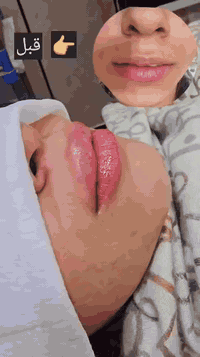 مركز تجميل • تجميل ليزر • بغداد الحسينيه