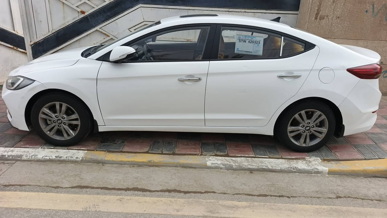 السلام عليكم النترا 2018 سوبر خليجي رقم بغداد باسمي تحويل مباشر سياره جديده مواصفات السياره
ميكنه ألفين دوش 
فتحه سقف
مري شفط+اشعاير 
شاشه كبير 
غرفه صاج
كِشينات جلد 
خمسه ويل كب
يدات نيكل 
حساس خلفي
تبريد ثلج 
ملاحظه /السياره بيها مكانين صبغ 
العنوان /كربلاء 
رقم الهاتف //  *********** /// السعر 138
