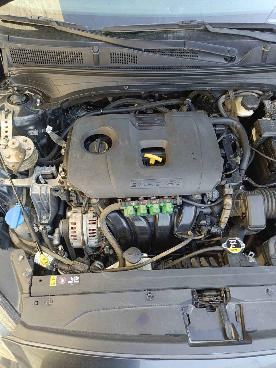 سلام عليكم كيه فورتي للبيع موديل 2020 حادثه جاملغ وشويه من البنيد سياره ليبل واحد كير ومكينه كفاله تخم تايرات جديد دوشمه عامه سياره احلاها من الصور ماشيه 94 السعر 127 وبيه مجال الاتصال بل رقم ***********
