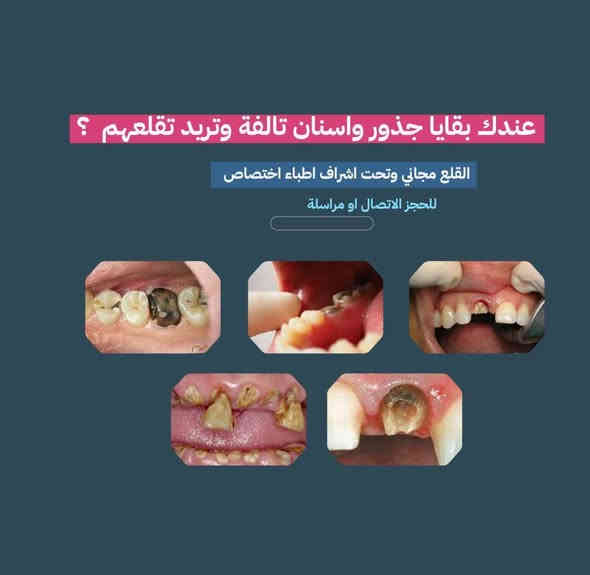 السلام عليكم 
اللي عنده مثل هاي الحالات او اي مشاكل ثانية خلي يتفضل خاص او يتواصل على الرقم ***********
علما بانه العلاج مجاني في جامعة العين
