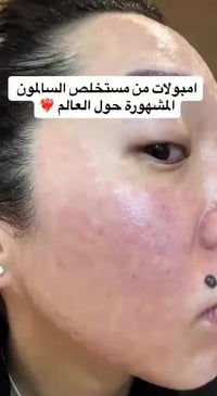 امبولات توهج • مستخلص سلمون • كوريا الأصلية