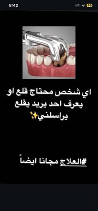 الي محتاج قلع اسنانه او تنظيف اسنانه او تركيب اسنان مفقوده خلي يراسلني...
