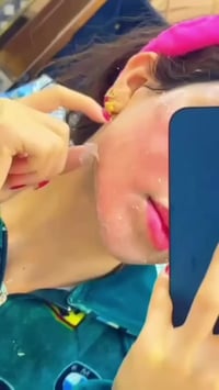 تقشير كيميائي • حب الشباب • عيادة هيلدا