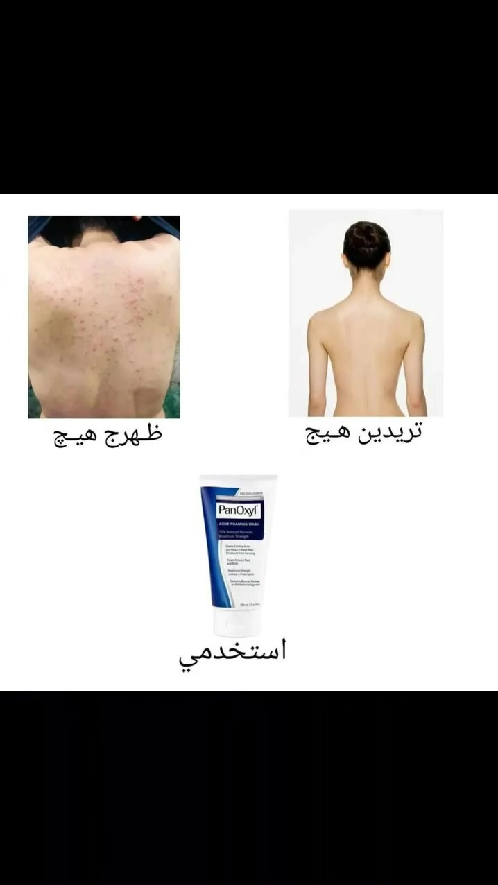 #الشعب #الصيني #مالة حل 😂🤣


**إذا كنت صاحب هذا الإعلان وتريد حذفه لأي سبب، رجاءا أرسل رسالة إلى الدعم الفني**