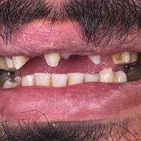 دكتور احمد المندلاوي • السوق الأول • جلسات سريعة