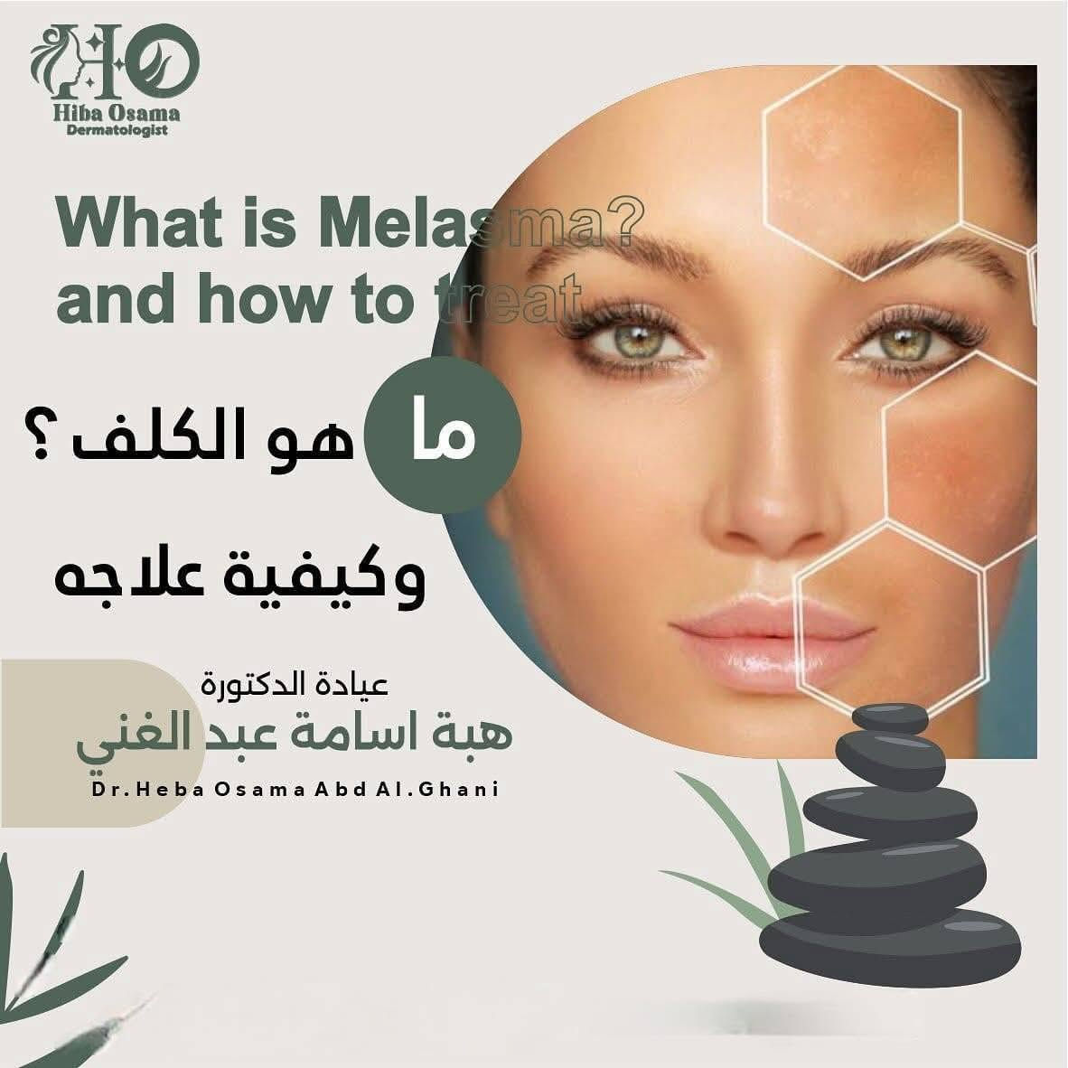 #الدكتورة هبة اسامة عبدالغني تتواجد غدا صباحا 
#تتواجد السبت صباحا
دكتوراه (بورد عراقي)الأمراض الجلدية و التجميل و العلاج بالليزر
زميلة الجمعية العراقية للأمراض الجلدية
بكالوريوس طب وجراحة عامة
زميلة المجلس العراقي للاختصاصات الطبية

M.B.CH.B.   F.I.B.M.S (D&V)
علاج الامراض الجلدية و الزهرية و حقن الفلر و البوتوكس و ازالة الشعر بالليزر -علاج الهالات السوداء و التقعر حول العين-علاج حب الشباب و اثاره-علاج الثالول و ازالة الزوائد اللحمية

للحجز و الاستفسار
***********
***********

العنوان
الحويجة _شارع الاطباء _مجمع الكندي الطبي
