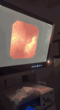 ( الدكتور. عدي علي جاسم الحياني) 
اخصائي جراحة الكلى والمسالك البوليه
شهادةالبوردالعربي(دكتوراه)
C. A. B. M. S..)(UROL)
علاج حصى الكلى والمسالك البولية والتشوهات الخلقية في الجهاز البولي
علاج البروستات والضعف الجنسي
وعقم الرجال
علاج سلس الادار عند الرجال والنساء عمليات تجميل المبال السفلي وتشوهات العضو الذكري 
ايام التواجد يوم السبت /الاحد /ولاثنين /  من كل اسبوع
——————
***********

عنوان المجمع :حديثة - الشارع الثاني - بالقرب من صيدلية عمر مؤيد
