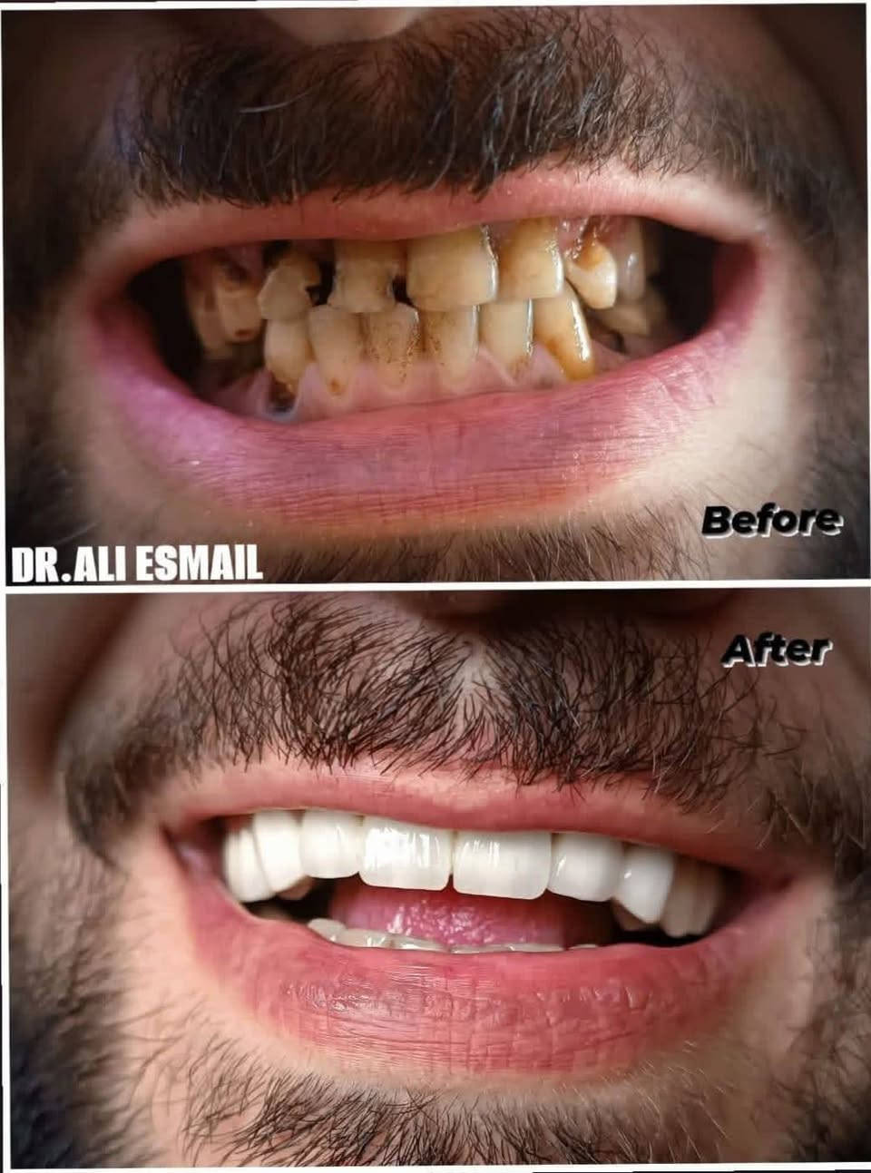 ضحكتك سر ثقتك.. حافظ عليها مع عيادة الياسمين🌸 🦷 الحشوات، التبييض، والتعويضات بأعلى جودة و انسب الاسعار 
في سوق الشيوخ الحي العسكري مقابل مضيف الإمام علي  احجز  الآن 📞 ***********
