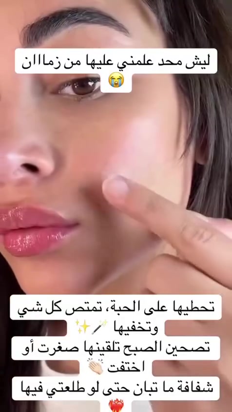 ✨ لاصقات حمض الساليسيليك لعلاج الحبوب ✨
الحل السريع لكل حبة مزعجة 😍🔥

✔️ تحتوي على 36 لاصقة
✔️ تساعد على تجفيف الحبوب بسرعة
✔️ تقلل الاحمرار والالتهاب
✔️ تمتص الدهون والشوائب من البشرة
✔️ مناسبة لكل أنواع البشرة

💖 استخدميها بكل سهولة وخلي بشرتچ صافية ونقية بدون آثار


**إذا كنت صاحب هذا الإعلان وتريد حذفه لأي سبب، رجاءا أرسل رسالة إلى الدعم الفني**