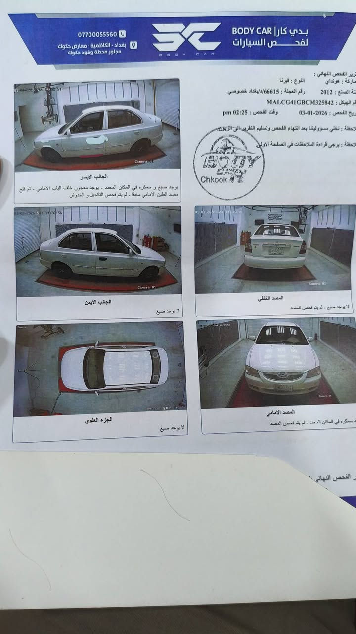 السلام عليكم
هونداي ڤيرنا موديل 12 استيراد الشركه العامه هزه وسنويه لل31 بسمي تحويل مباشر گير مكينه تبريد كله جديد عالشركه تخم تاير دوشمه جديد كير اوتو جام كهرباء تجي باور ستيرن موالعاديه ماشيه 149 الف سونارها منزله شوفه واقتنع وخابرني اخليك على راسي مكانها دوره شارع ستين السعر 80 وبيها مجال قليل 
***********
