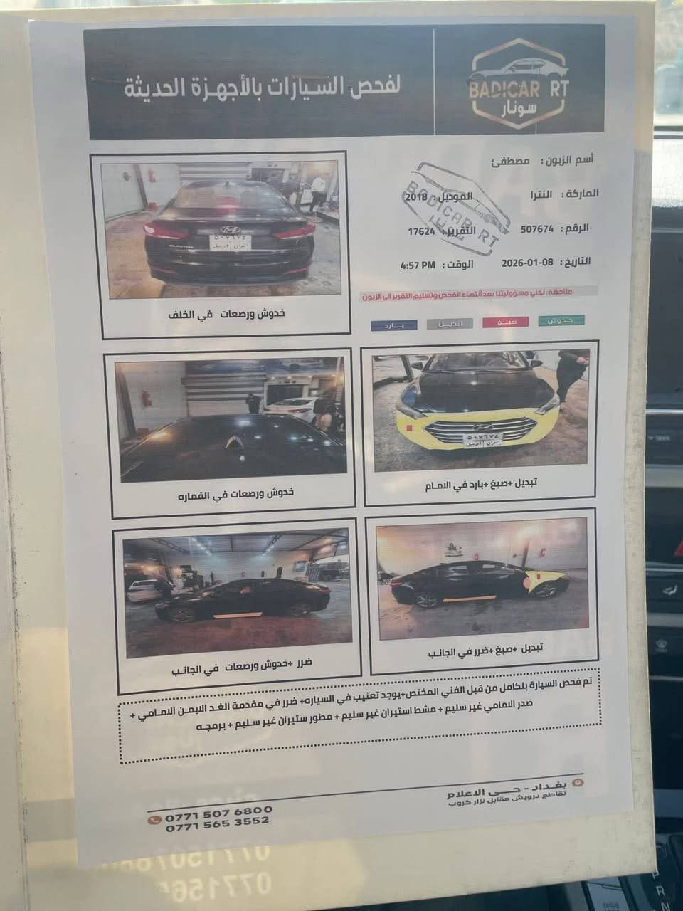 السلام عليكم
النتر ٢٠١٨
ماشيه ٧٣ ميل
رقم اربيل الجديد ب اسمي
هزه جديدة 
حادثها جاملغ وخشم بنيد قظعه وحده صبغ
موجود سونار
١١٨$ وبيها مجال بسيط


**إذا كنت صاحب هذا الإعلان وتريد حذفه لأي سبب، رجاءا أرسل رسالة إلى الدعم الفني**