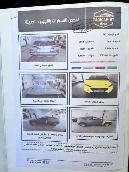 كونا ٢٠٢١ مكينة ٢٠٠٠ دوش كير at المرغوب حادثها جاملغ الأيمن والبنيد مبدلات بلخارج أصليات سيارة ماشية ٩٦ الف حقيقي
الموصفات رقم بغداد باسمي تحويل ثاني يوم سنوية الحد ٢٠٢٩
١ ٣ أنظمة قيادة
٢ كشنات تدفئه
٣ شاشة كار بلي 
٤ مانع انزلاق
السيارة نظيفة جدا مثل ما موضح بلصور الغرفة نظافة ١٠٠٪؜
تبريد تلج ❄️
سعر ١٤٤ $
العنوان بغداد الجديدة ***********
