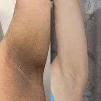 ✅⚡مقاومة الإنسولين تعني أنّ جسمك ما يستجيب بصورة طبيعية لهرمون الإنسول...