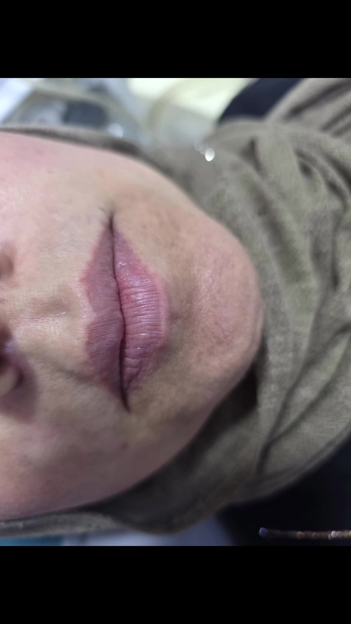 #اكسبلور_فولو #اكسبلور_explore #تجميل #فلر #عيادات


**إذا كنت صاحب هذا الإعلان وتريد حذفه لأي سبب، رجاءا أرسل رسالة إلى الدعم الفني**