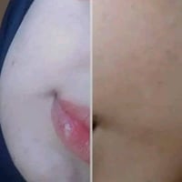 خلطة عشبية • طبيعية • مجربة