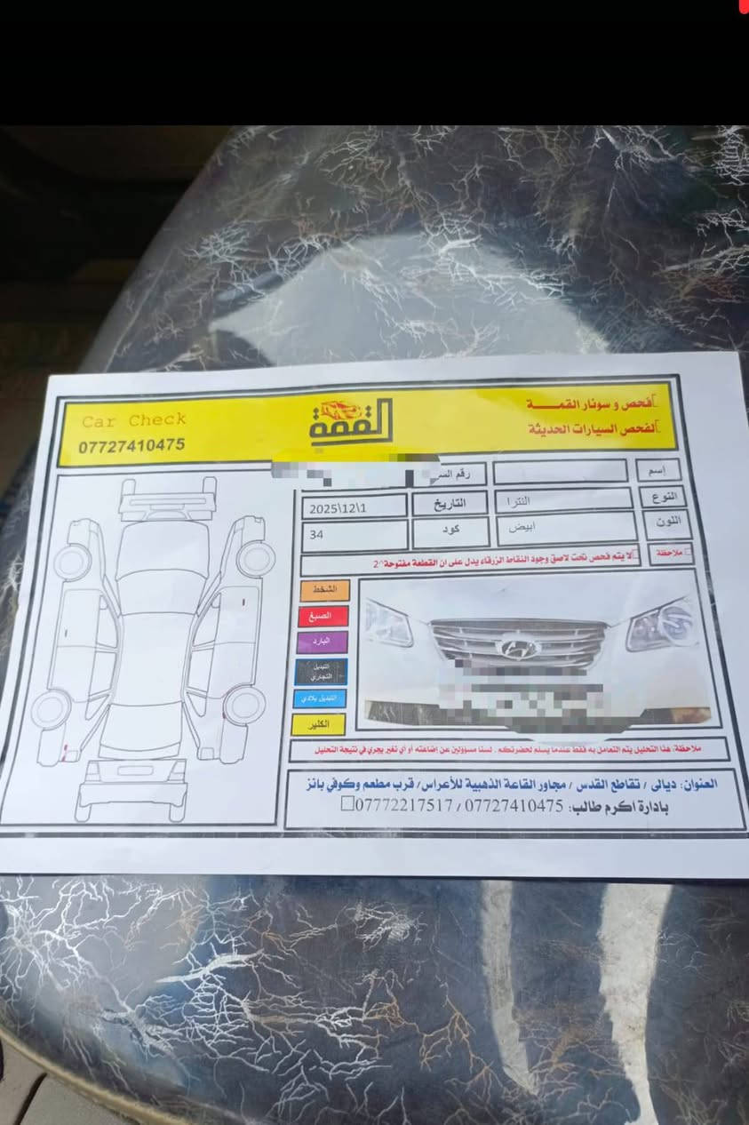السلام عليكم انترة 2011  بسمي شخصيا تحويل 2يوم مكفولة كفالة عامه من كلشي 
مكينه على البلاد فول مواصفات سيارة جديدة والسونار منشور  السعر 130 مكاني ديالى بعقوبة 
***********
