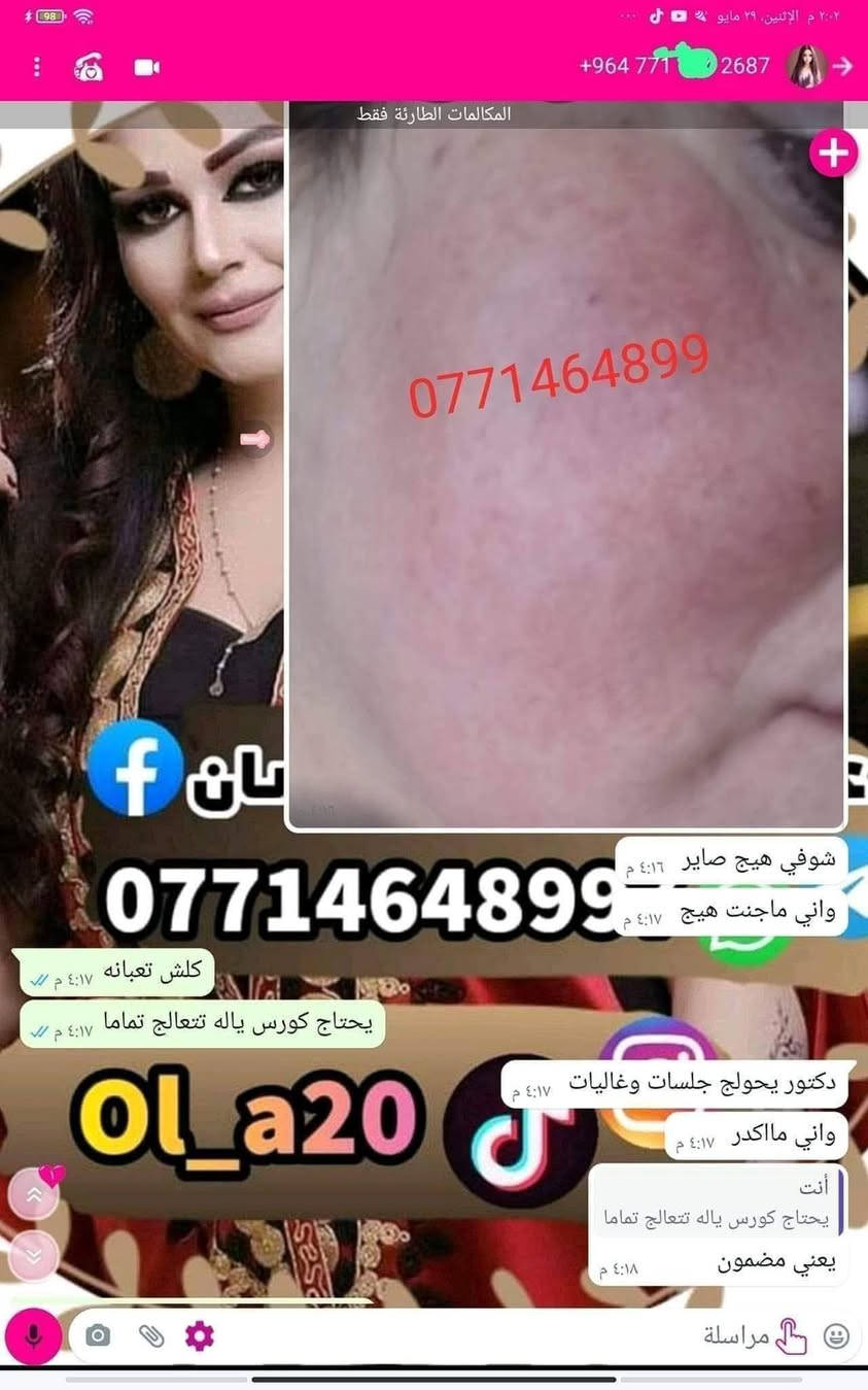 🙏انتبااااااااااه 🙏  الحجز فقط (وتساااااب ) علا اوليفيرا  ***********77
الي يعانوون من جميع مشاكل البشره مع منتجاتنا الطبيعيه  تمتعي ببياض الثلج 😍
 معالج الفااوربتين و السيراميد والعنبر وسيروم الباكشويل وسيىوم النضاره بكج متكامل 
تفتح البشرة 7 درجات والنتيجة دائمية 👌 وهذي تجارب زبائني تشهد 
خدمه توصيل لجميع محافضات
