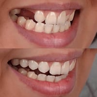 تعويض أسنان • جامعة كربلاء • حي الموظفين