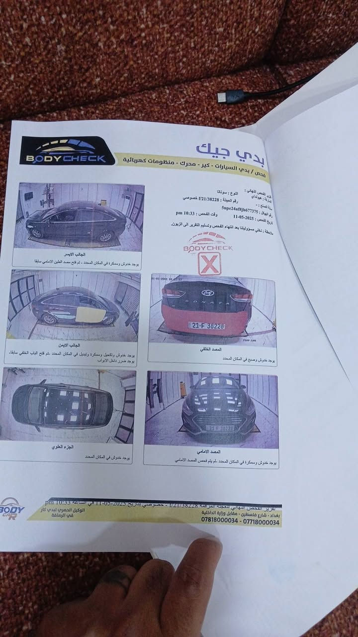 السلام عليكم سوناتا 2018 رقم سليمانيه حادثها بابين بدون دواخل 
بلعراق تبديل قبق جنطه للستفسار *********** 
السعر 115 بيها مجال قليل
