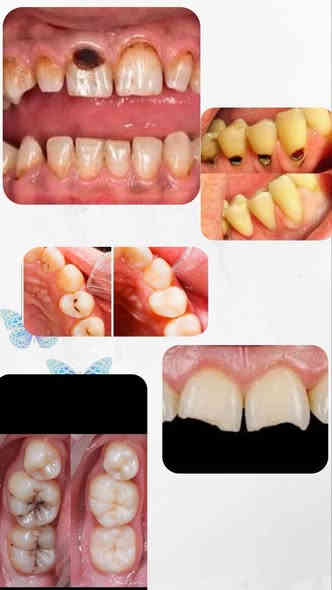 السلام عليكم ورحمة الله وبركاته 
الي يحتاج قلع جذور متبقية او تنظيف تكلسات او حشوات متواجدين بالعيادات وبشكل مجاني كامل 
موقع العيادة الحلة شارع اربعين مجاور صيدلية سلامتك
***********  للتواصل على هذا الرقم
