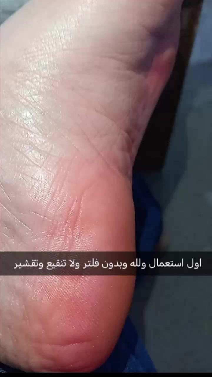 معالج قدم اقوى جفاف يعالجه


**إذا كنت صاحب هذا الإعلان وتريد حذفه لأي سبب، رجاءا أرسل رسالة إلى الدعم الفني**