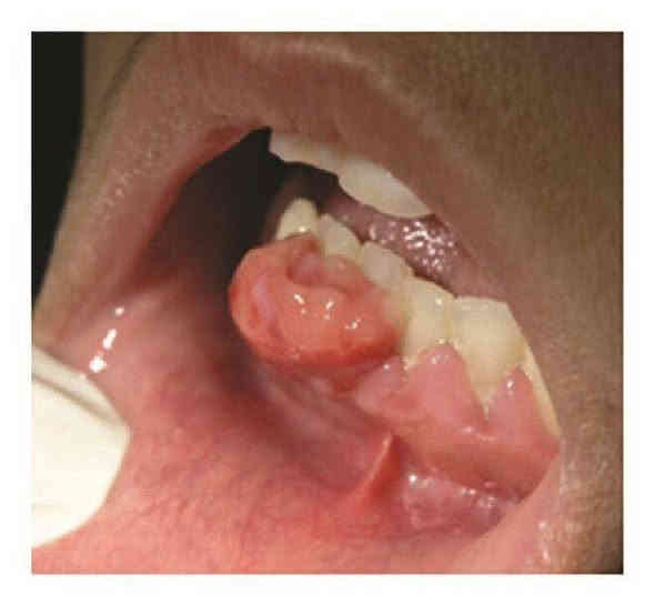 📍مجانا 
 سلام عليكم , الي عنده مثل هاي الحالات يتواصل ويايه نعالجها اله 
*العنوان / كربلاء الجمعيه خلف مول الحارث مجاور سيطرة الاحياء او كراج المخيم 
للحجز التواصل على واتساب  
* ***********

او الي عنده الم بمفصل الفك او طقطقه اثناء الاكل والكلام  او صعوبه بفتح الفم 
هم يتواصل ويايه
