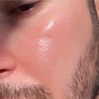 بشرة صافية • كريم تبيض • نضارة البشرة • إزالة الكلف • إزالة النمش • عل...